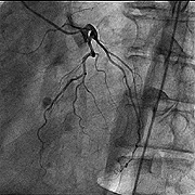 Cardiac_2_180